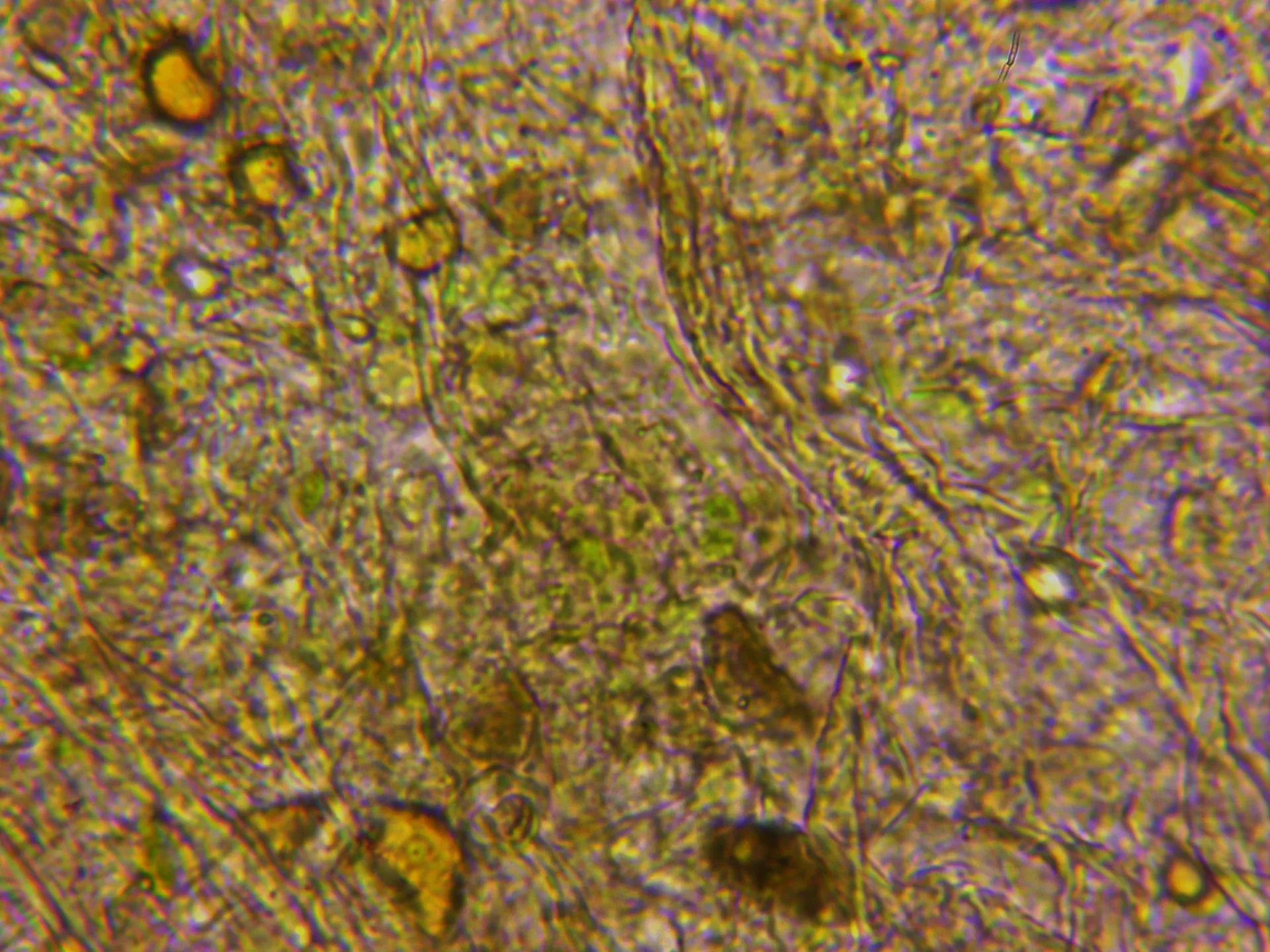 Microscopía de Physarum album - 10 - Contexto pié